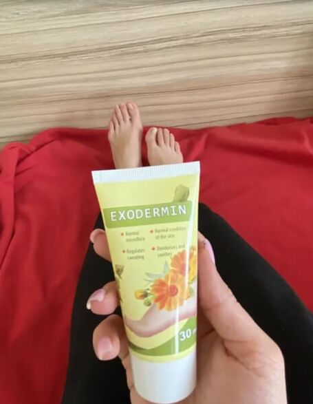 Review on Yesenia's Exodermin cream