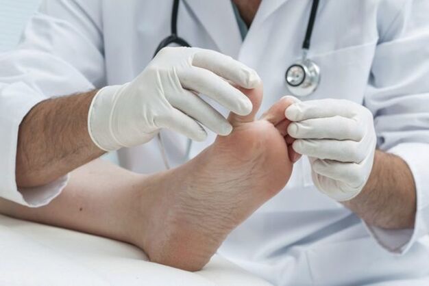 foot fungus diagnosis by your doctor